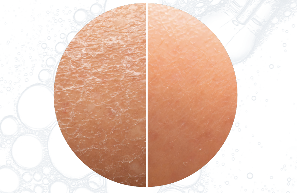 LaDonna Kosmetik Rottenburg - Argireline